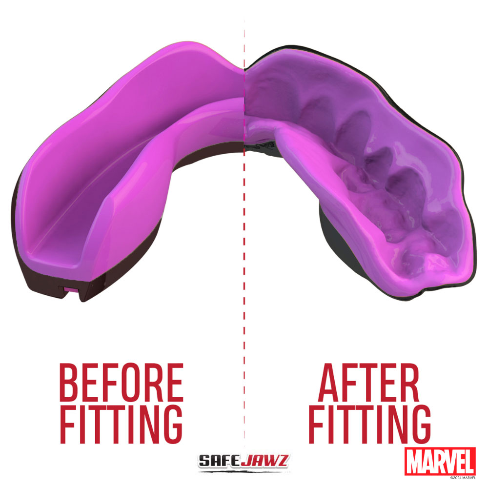 SAFEJAWZ MARVEL™ BRACES CAPTAIN AMERICA