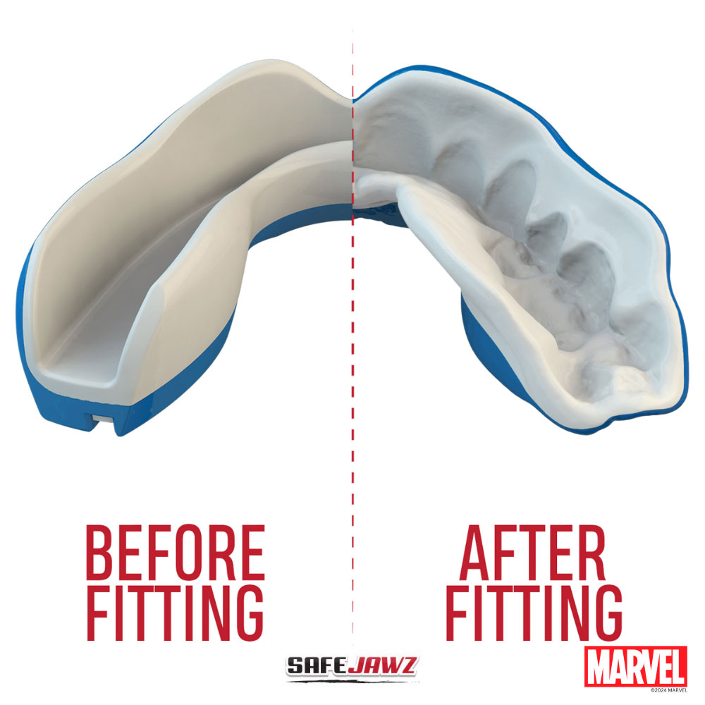 SAFEJAWZ MARVEL™ BRACES CAPTAIN AMERICA