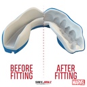 SAFEJAWZ MARVEL™ BRACES CAPTAIN AMERICA