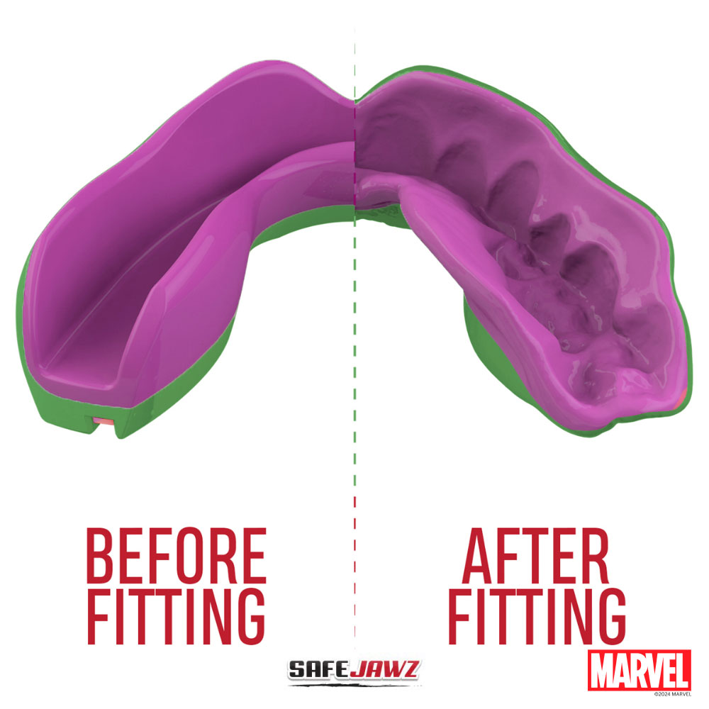 SAFEJAWZ MARVEL™ BRACES CAPTAIN AMERICA